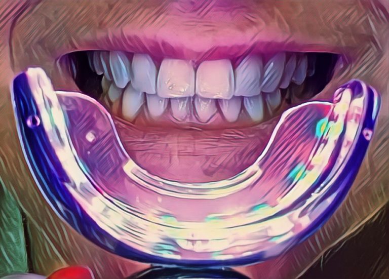 Phonebleaching – hit czy kit?